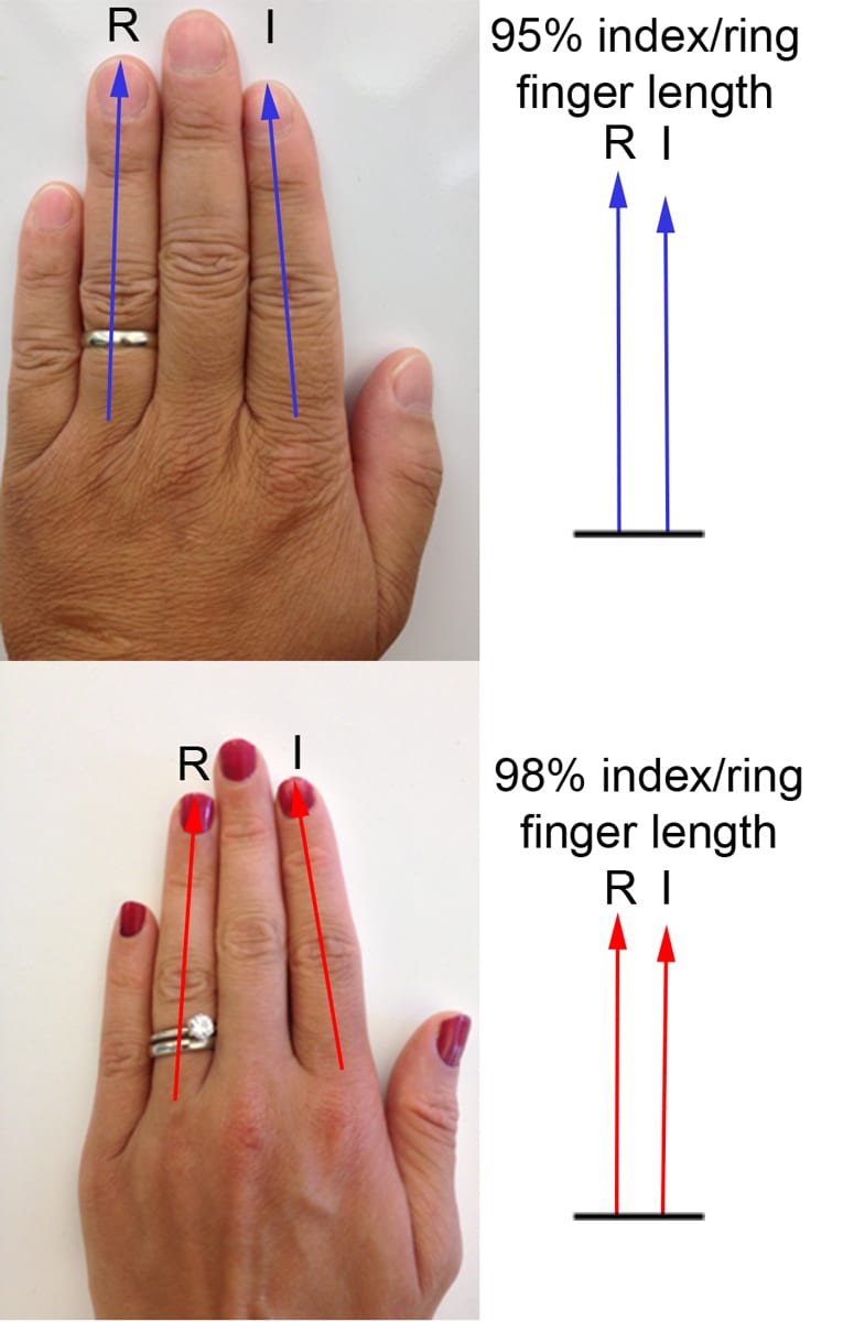 Linear trend contrast (index finger < middle finger < ring finger