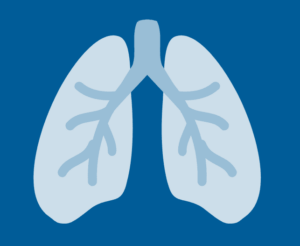 Illustration for Idiopathic Pulmonary Fibrosis